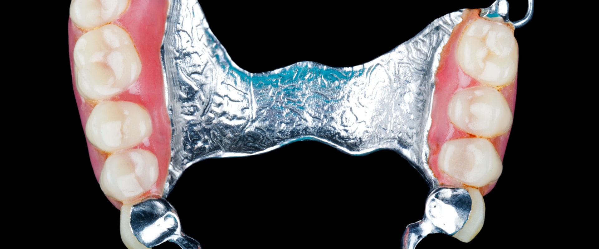 What are the most realistic dentures?