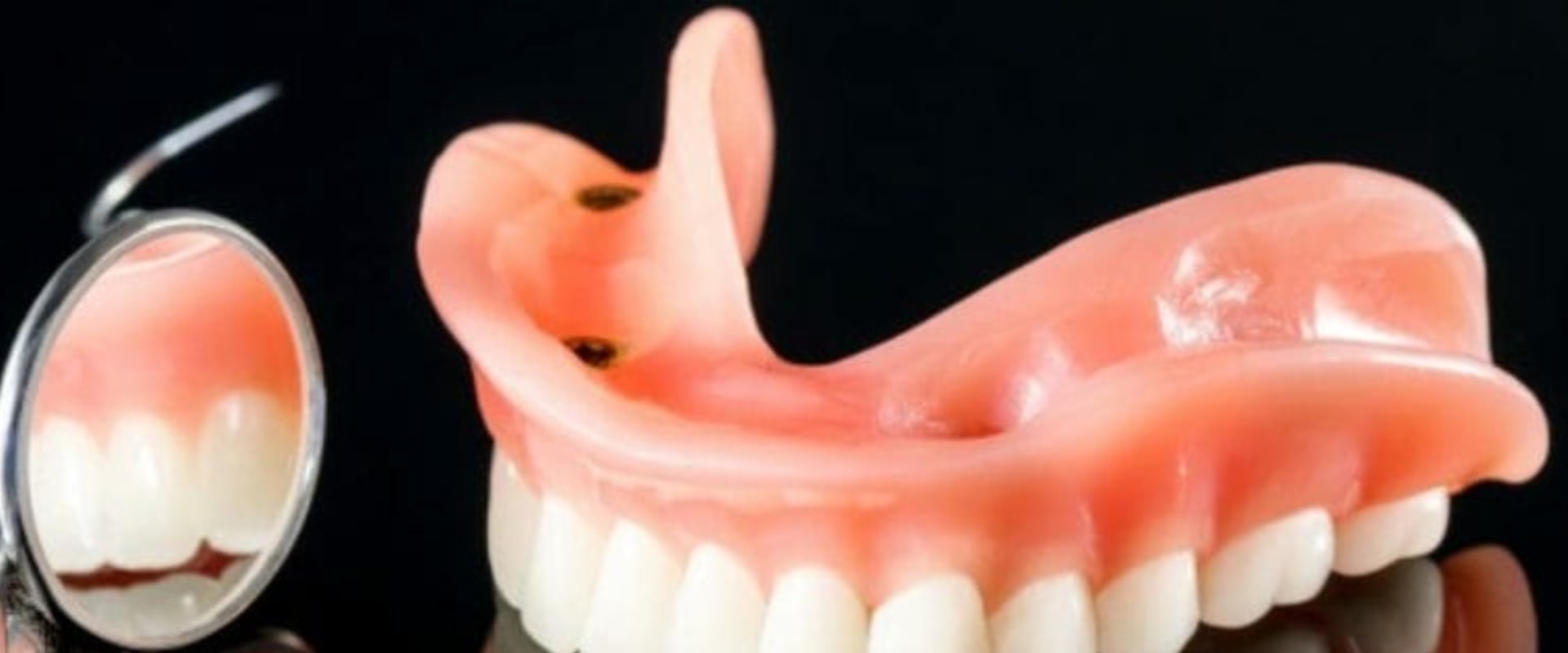 What are the four types of dentures?