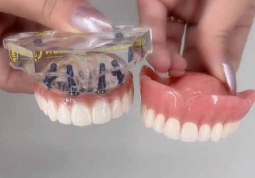 What is a better option than dentures?