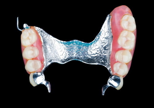 What are the most realistic dentures?