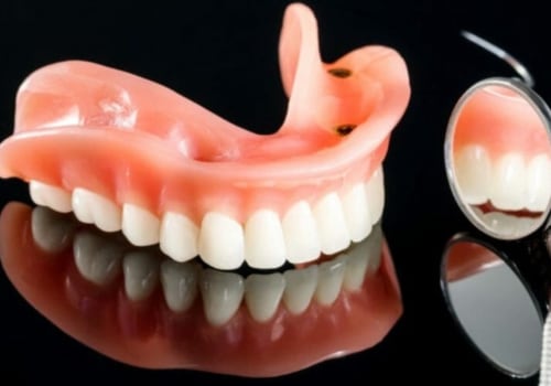 What are the four types of dentures?